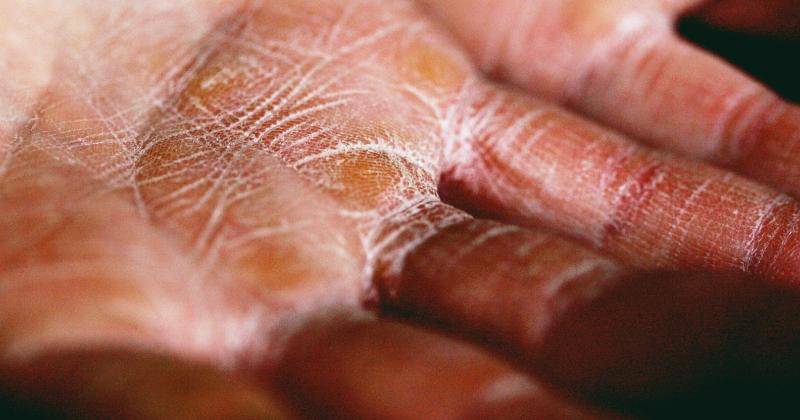 Unsplash/Alexander Gray